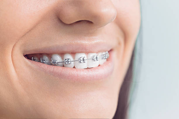 Trusted Peoria, AZ  Holistic Dental Services Experts